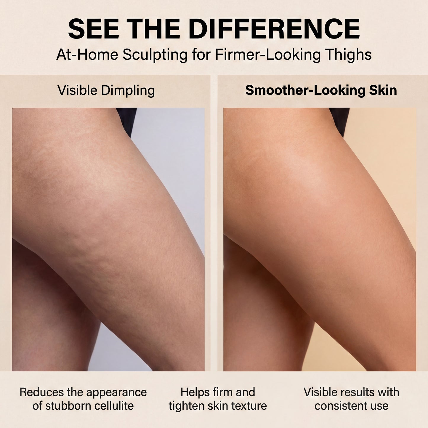 Elvion™ Cellulite Massager